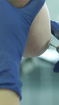 Removal of the hard keratinized layer from the heel skin using the grinding tool. Podology and pedicure. Foot care. High quality 4k footage