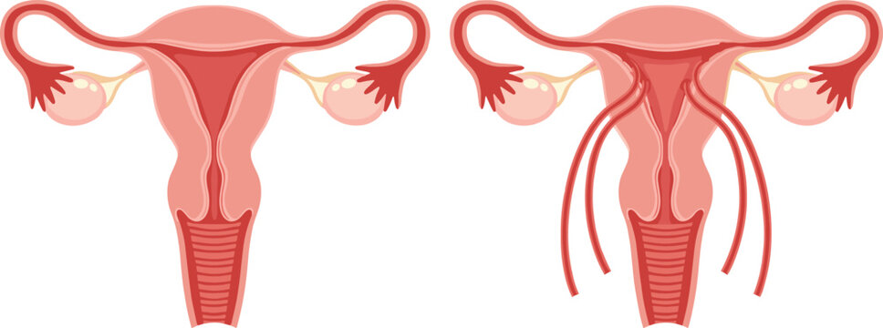 Female Reproductive System Anatomy Vector Set Showing Uterus Ovaries and Fallopian Tubes for Medical Education Healthcare Infographics and Gynecology Science Designs