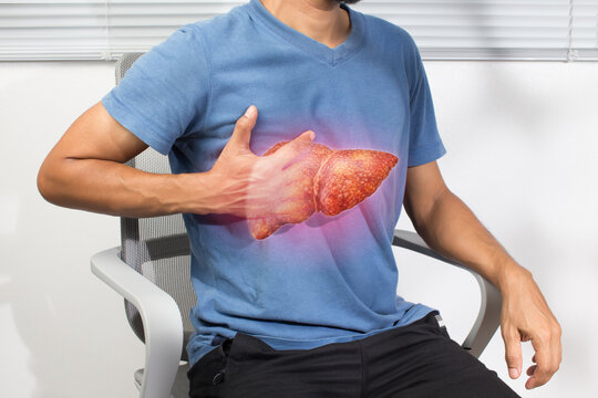 Male holding abdomen with highlighted liver illustrating cirrhosis hepatitis inflammation and related complications in healthcare concept