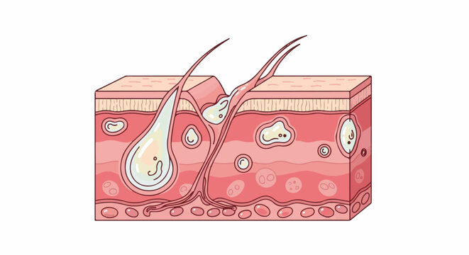 Cross-section of skin layers showing hair follicles and sebaceous glands