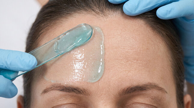 Applying cooling gel on woman's forehead for cosmetic facial treatment