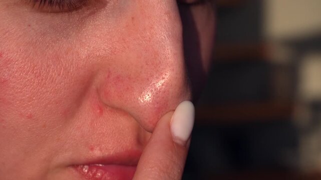 Close up of young woman nose with visible blackheads and pores. Skincare concept, clogged pores, dermatology and natural skin texture without retouching.