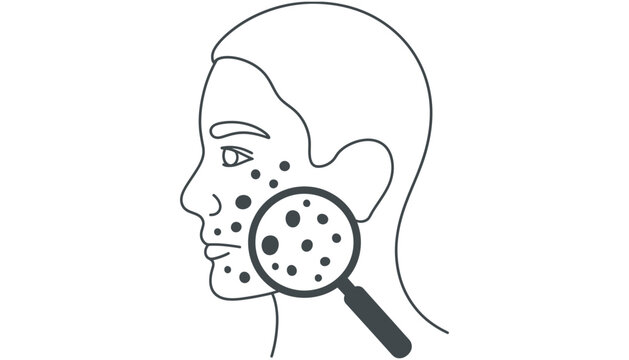 Acne vector illustration of a woman's face with magnifying glass