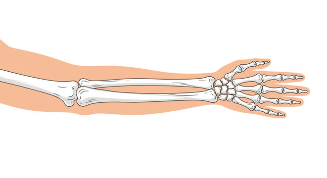 Anatomical illustration showing the bone structure of a human arm including the radius ulna carpals metacarpals and phalanges.