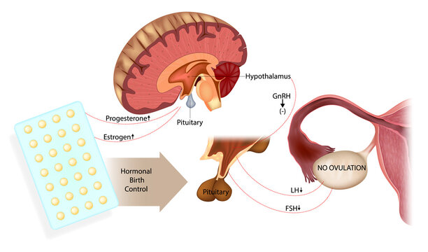 Hormonal birth control mechanism diagram showing hypothalamus pituitary ovary axis inhibition GnRH FSH LH suppression and ovulation prevention medical illustration.
