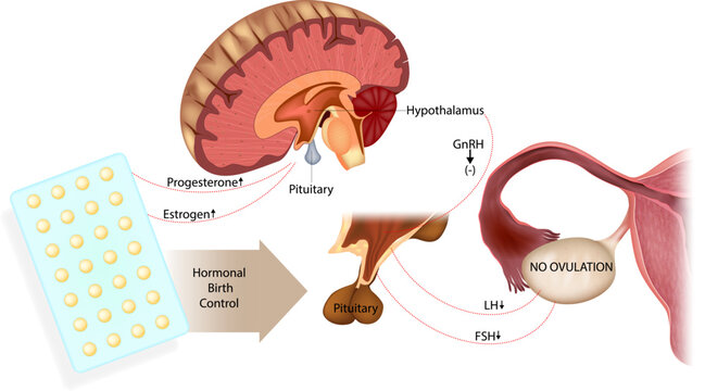 Hormonal birth control mechanism diagram showing hypothalamus pituitary ovary axis inhibition GnRH FSH LH suppression and ovulation prevention medical illustration.