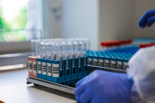 Meticulous Management Of Laboratory Samples For Accurate Diagnostic Testing During Health Emergencies