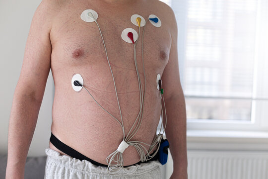 Man with heart monitoring equipment.  Unrecognizable patient wearing holter monitor device for exam of electrocardiogram