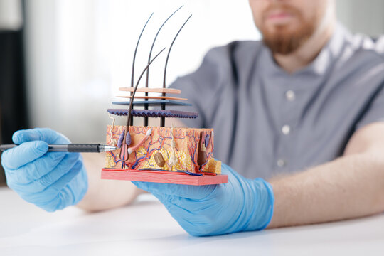 Closeup medical hair skin cross section model, doctor in gloves for dermatology education for trichologist