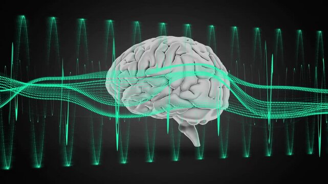 Teal sine-wave band sweeping through 3D brain model, rotating while pulse columns showing signals