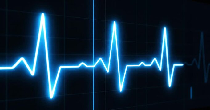 Blue electrocardiogram waveform displaying heartbeat patterns on a dark background