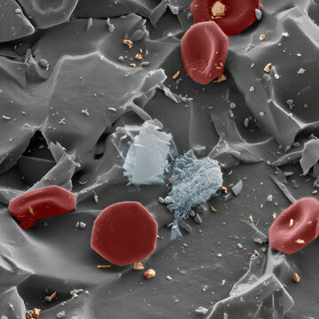 Scanning electron micrograph: Erythrocytes on microplastic fracture surface