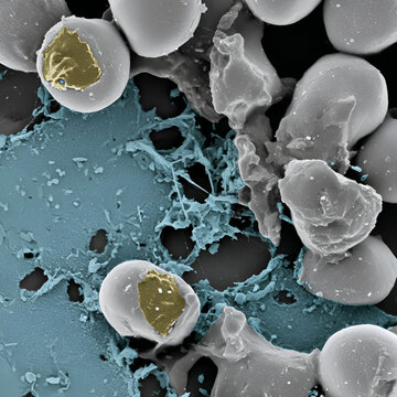 Scanning electron microscope image: Synthetic microfibers in contact with human red blood cells