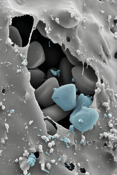 Scanning electron microscope image: Human erythrocytes trapped in plastic pores