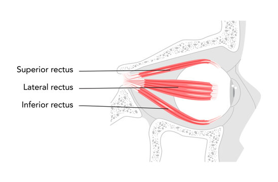 Superior Lateral Inferior rectus - Human eye muscle shown in labeled anatomy chart, controls upward and inward eye movement, important for ocular alignment, medical and educational illustration.
