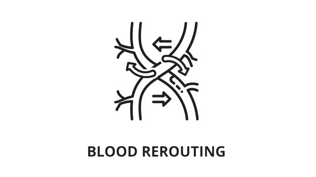 a medical illustration depicting blood rerouting, a surgical procedure to redirect blood flow, used in healthcare, medicine, and education