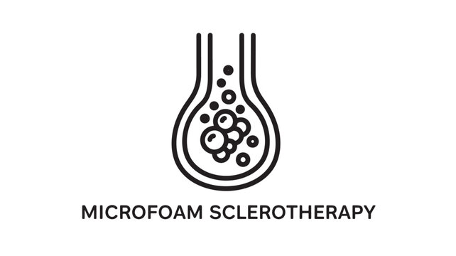 Minimalist line art depicting microfoam sclerotherapy, a medical procedure for treating varicose veins. Ideal for healthcare brochures, educational materials, and medical marketing content.