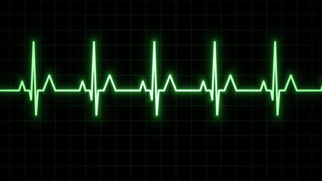 Heartbeat Monitor Display Animation on Black Grid Screen