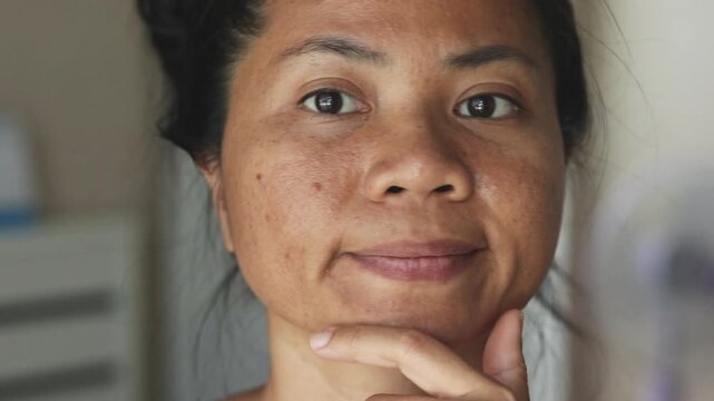 Young woman examines acne on her cheek with a concerned expression, showing discomfort and insecurity while checking her skin condition at home.
