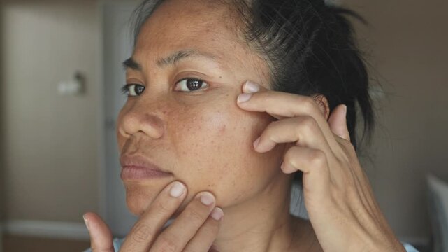 Close-up of a woman examining acne and facial imperfections using both hands, turning her head to check both cheeks. Focused inspection, natural light and real texture. Skincare and dermatology concep