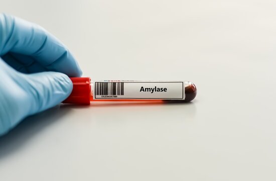 Blood sample tube for amaylase test analysis.