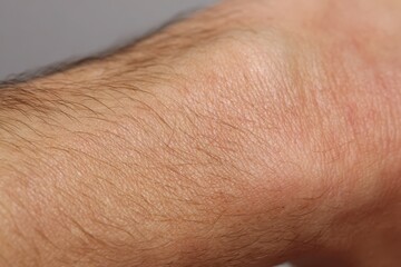 Fototapeta premium Close-up macro view of human skin texture with fine hairs and subtle wrinkles, detailed surface.