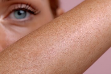 Fototapeta premium Close-up of a woman's blue eye and freckled arm against a soft pink background, abstract beauty shot.