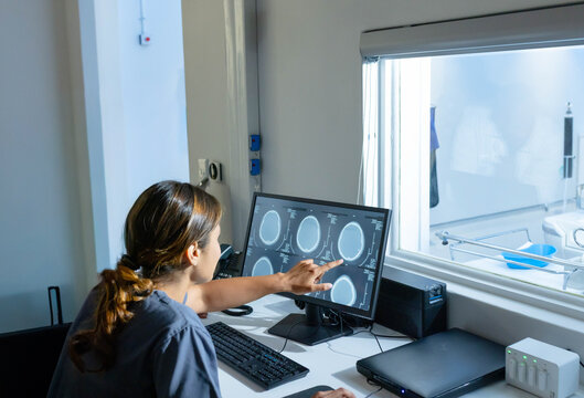 African American woman in dark scrubs pointing at brain scan monitor at radiology control room