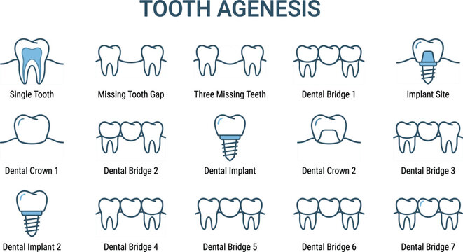Professional tooth agenesis icon set illustrating dental bridge implants and crown restoration solutions for missing teeth clinical dentistry.
