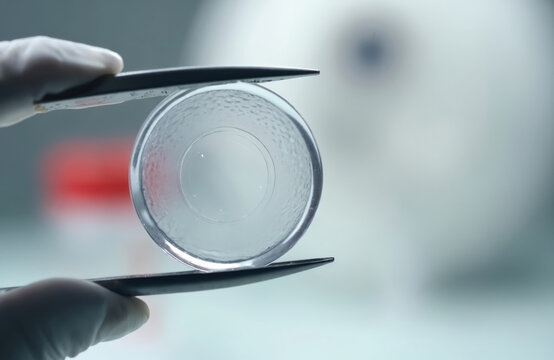 Ophthalmologist holds tiny transparent intraocular lens with surgical tweezers for eye vision correction. Micro lens used for implant surgery to fix sight problems like myopia.