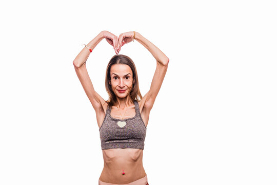 Woman showing heart shape with emaciated arms