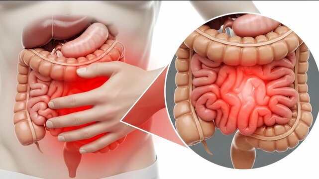 Abdominal discomfort, a severe intestinal disease, depicting inflamed bowel and painful digestive system issues, requiring urgent medical diagnosis and treatment