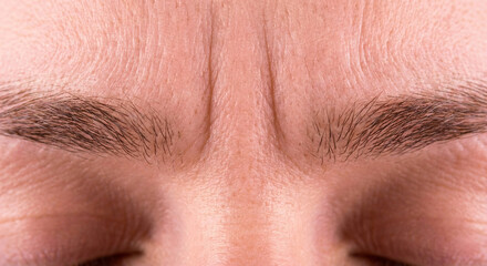 Naklejka premium Person showing forehead wrinkles before botox treatment indoors