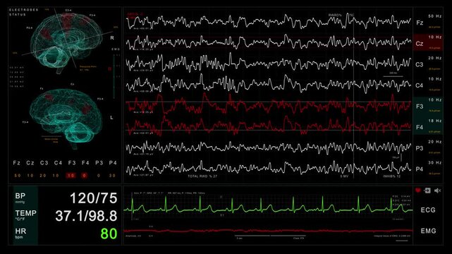 Advanced digital medical monitor displaying real-time brain activity, vital signs, and fluctuating neurological waveforms footage.