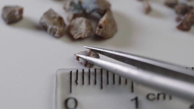 Fragments of a kidney stone crushed by ultrasound with a diameter of 1.5 centimeters