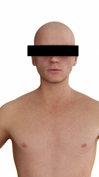 Scarlet Fever Rash | A man with Scarlet Fever Rashes in vertical video