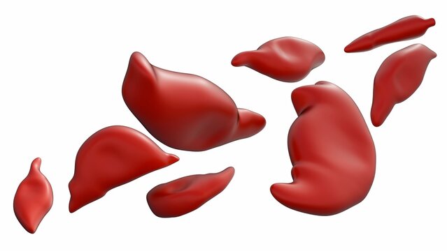 3D medical illustration of schistocytes: fragmented, irregular red blood cells. These jagged "helmet" shapes signify microangiopathic hemolytic anemia or physical blood cell damage.