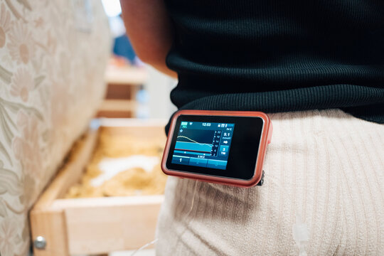 Rear view midsection of girl with modern insulin pump clipped on pants displaying glucose level graph
