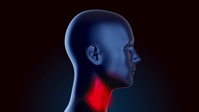 Profile view of 3D human head model with localized red inflammation on throat and neck area. High quality medical animation symbolizes cervical ache, muscle strain or viral infection