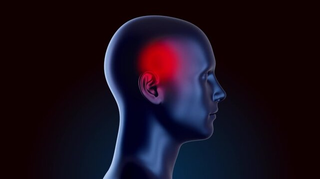 Side view of 3D animation human head model with localized red glow on temple area. Anatomical visualization represents a one-sided migraine, temporal arteritis, or localized head pain