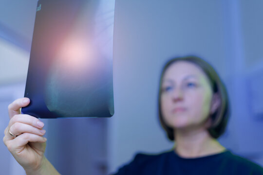 Patient inspecting chest xray negative mammogram in dim radiology room