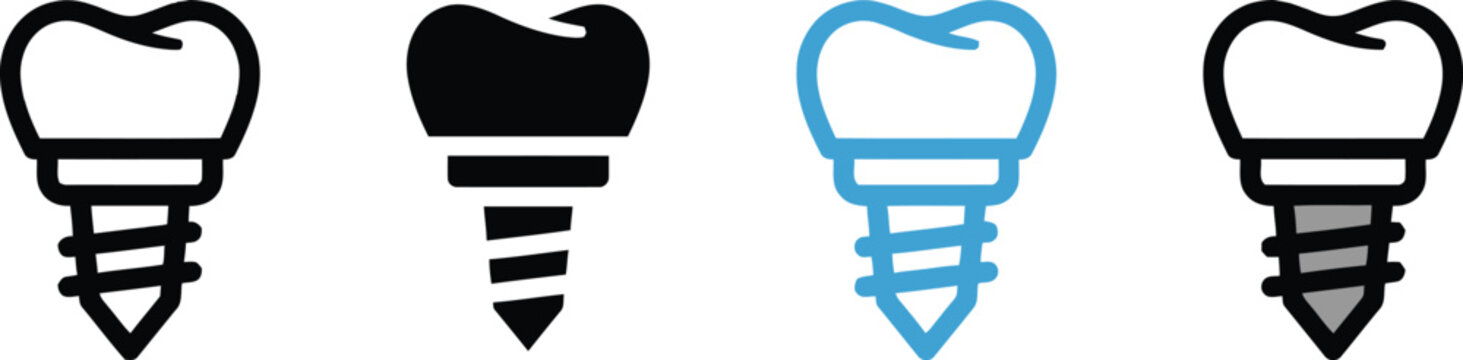 Dental implants and tooth stages a visual representation of restoration