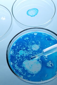Petri dishes and pipette with liquid samples on light blue background, closeup
