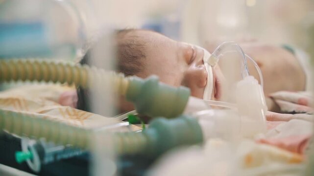 Closeup lovely little newborn baby infant lying in incubators for newborns, Newborn baby having the the breathing problem after birth, newborn in NICU, Neonatal intensive care unit.