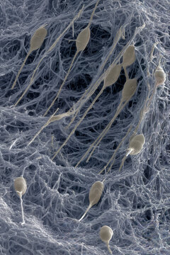 Human Sperm Cells Interacting with Zona Pellucida Microfibrils
