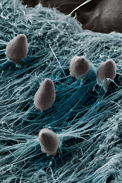 Human Sperm Binding to Zona Pellucida Microfibrils FESEM