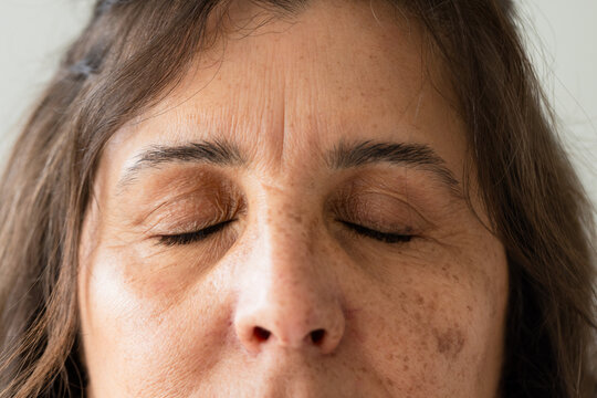 Female showing closed eyes and textured skin with freckles and sunspots in studio