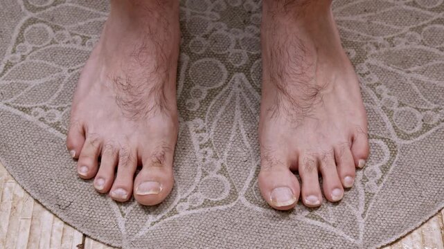 Close-up of a man's hairy feet with damaged and uncared for toenails standing on a patterned rug. View from a personal perspective