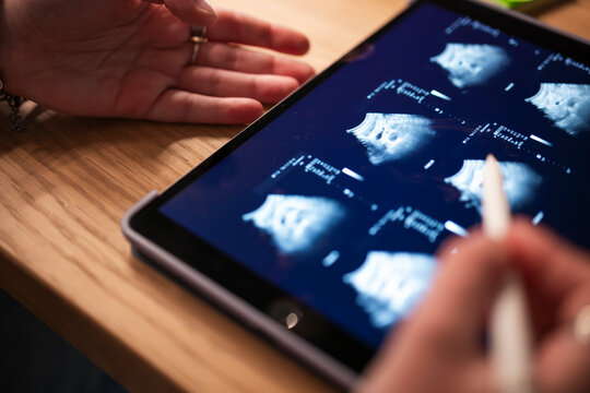 A person reviews ultrasound images on a tablet, using a stylus to interact with the screen.