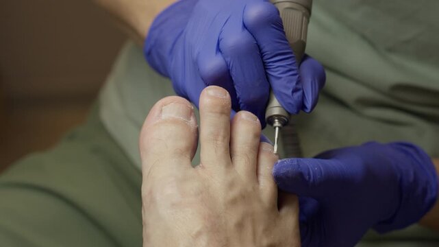 Closeup white foot nail technician shapes toenails using small drill, controlled strokes. Patient relaxed.